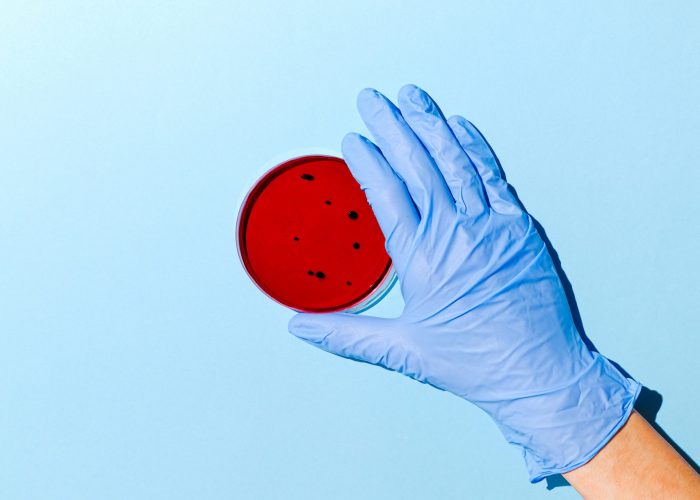 Canva - Person Holding Red Petri Dish